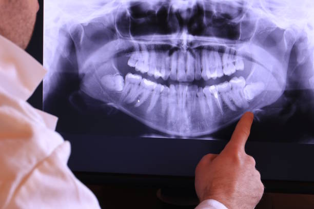Best Broken or Cracked Tooth Emergency Dentist in Cordry Sweetwater Lakes, IN