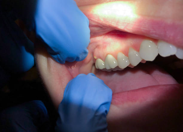 Best Emergency Cosmetic Dentistry in Cordry Sweetwater Lakes, IN